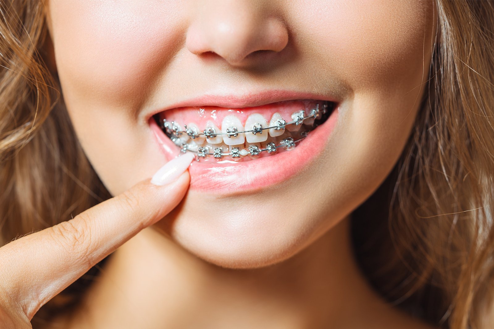behel ortho